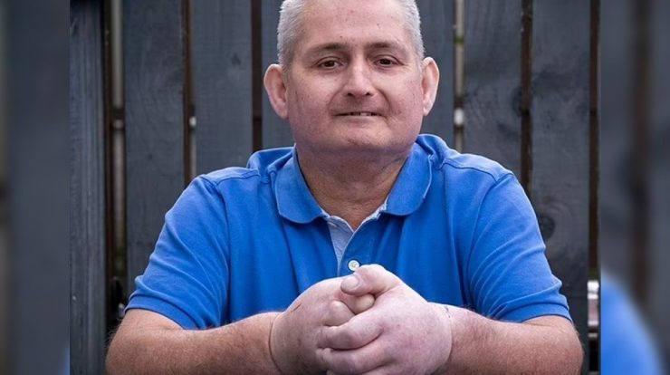 A person living in the UK undergoes double arm transplant surgery