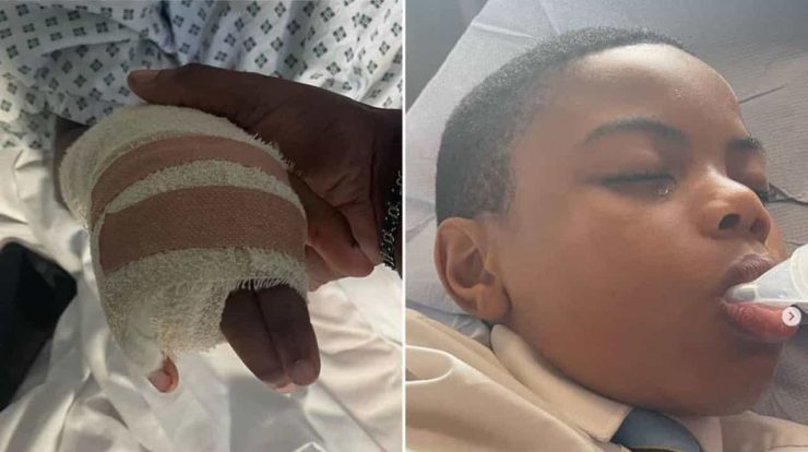 An 11-year-old boy lost his finger during a bullying episode in the UK