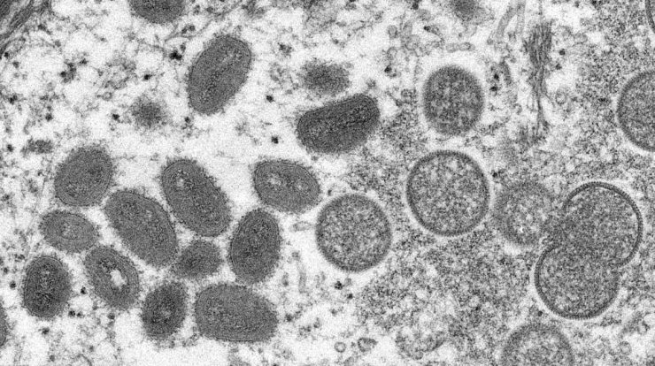 Health professionals receive guidance on monkeypox