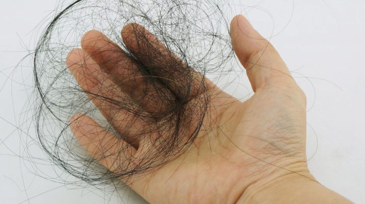 Goodbye hair loss!  Stop eating this and get your hair back to good health