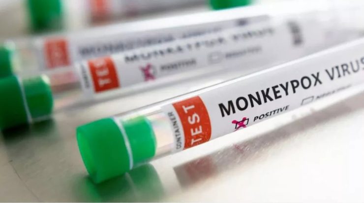 Royal Jordanian inaugurates monkeypox testing stations;  Iaserj, in Maracanã, is the first |  Rio de Janeiro